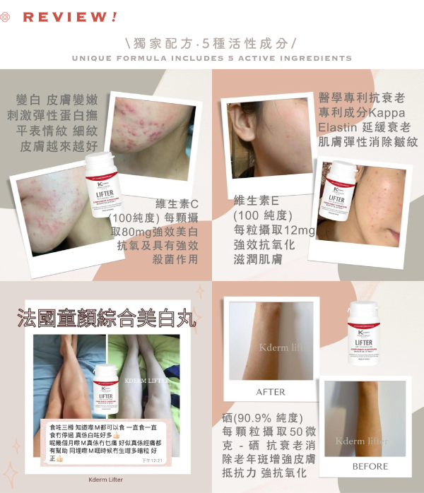 Customer review and before-and-after results collage for K'DERM Lifter at Grandmama Store in Hong Kong.