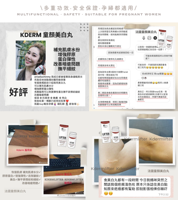 Customer review feedback and skin comparison collage for K'DERM Lifter at Grandmama Store in Hong Kong.